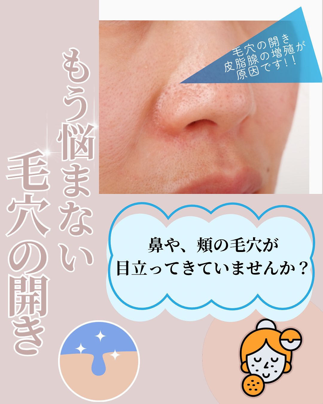 もう悩まない 毛穴の開き
