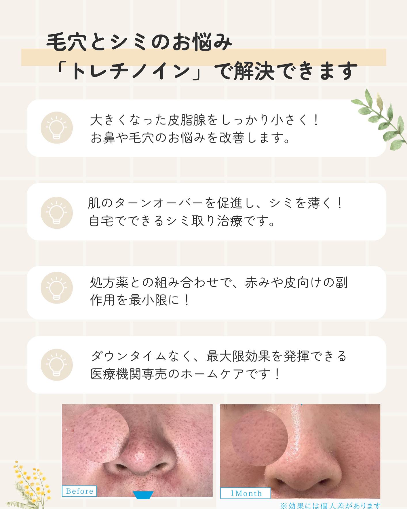 毛穴とシミのお悩み「トレチノイン」で解決できます